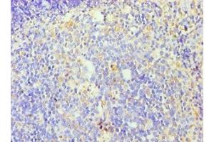 Immunohistochemistry of paraffin-embedded human tonsil tissue using ABIN7176253 at dilution of 1:100 (ZNF346 antibody  (AA 1-294))