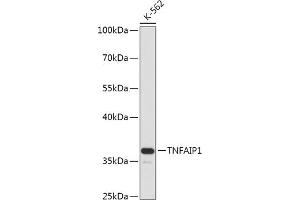 Western blot analysis of extracts of K-562 cells, using TNF antibody (ABIN7271074) at 1:1000 dilution. (TNFAIP1 antibody  (AA 90-160))