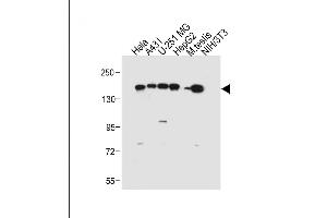 All lanes : Anti-RECQL4 Antibody (C-term) at 1:2000 dilution Lane 1: Hela whole cell lysate Lane 2: A431 whole cell lysate Lane 3: U-251 MG whole cell lysate Lane 4: HepG2 whole cell lysate Lane 5: Mouse testis tissue lysate Lane 6: NIH/3T3 whole cell lysate Lysates/proteins at 20 μg per lane. (RECQL4 antibody  (C-Term))