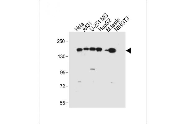 RECQL4 antibody  (C-Term)