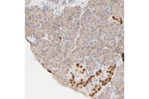 Immunohistochemical staining of human pancreas with NKX2-2 polyclonal antibody  shows strong nuclear positivity in islet cells. (Nkx2-2 antibody)