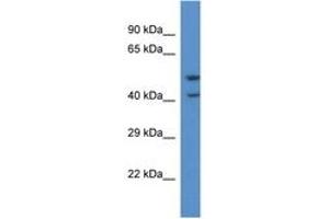 Image no. 1 for anti-Pyroglutamylated RFamide Peptide Receptor (QRFPR) (C-Term) antibody (ABIN6746840) (QRFPR antibody  (C-Term))