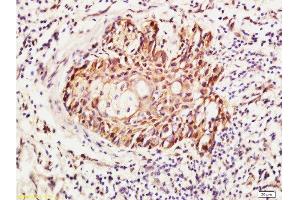 Formalin-fixed and paraffin embedded human skin labeled with Anti-RhoA Polyclonal Antibody , Unconjugated 1:400 followed by conjugation to the secondary antibody and DAB staining (RhoA, C (AA 101-193) antibody)