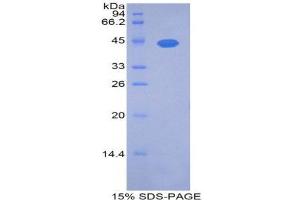 SDS-PAGE (SDS) image for Noggin (NOG) (AA 1-117) protein (His tag,GST tag) (ABIN1525542) (NOG Protein (AA 1-117) (His tag,GST tag))