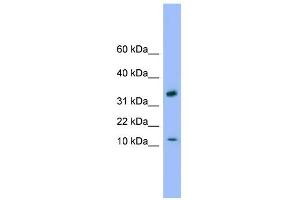 WB Suggested Anti-GABARAP Antibody Titration: 0. (GABARAP antibody  (C-Term))