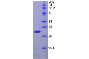 Ribonuclease P protein