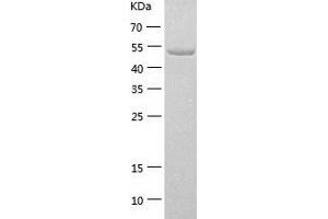 NPR1 Protein (AA 33-473) (His tag)
