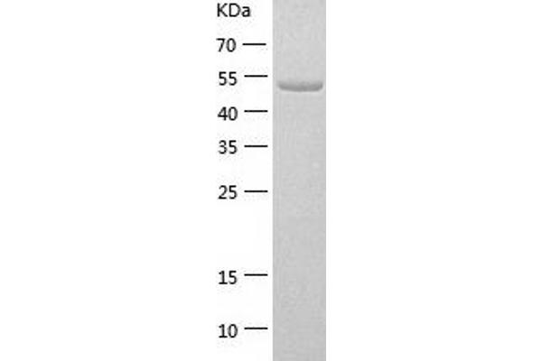 NPR1 Protein (AA 33-473) (His tag)