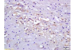 Formalin-fixed and paraffin embedded rat brain tissue labeled Anti-Ets1/ETS-1 Polyclonal Antibody, Unconjugated (ABIN674424) at 1:200, followed by conjugation to the secondary antibody and DAB staining (ETS1 antibody  (AA 321-441))