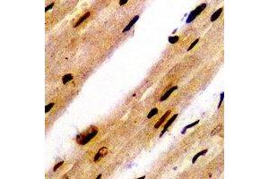 Immunohistochemical analysis of PSMB8 staining in rat heart formalin fixed paraffin embedded tissue section. (PSMB8 antibody)