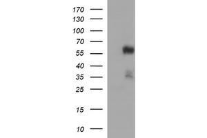 Western Blotting (WB) image for anti-Tubulin, alpha 1B (TUBA1B) antibody (ABIN2715958) (TUBA1B antibody)