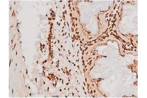 Immunohistochemistry (IHC) image for anti-REL proto-oncogene (c-Rel) (pSer503) antibody (ABIN6255382)