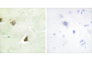 Peptide - + (DUSP6 antibody)