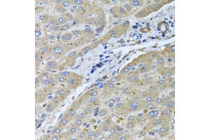 Immunohistochemistry of paraffin-embedded human liver injury using UGT2B10 antibody. (UGT2B10 antibody)