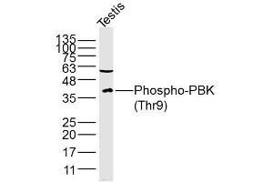 Lane 1: Mouse testis lysates probed with PBK/TOPK(Thr9) Polyclonal Antibody, Unconjugated (bs-3326R) at 1:300 overnight at 4˚C. (PBK antibody  (pThr9))