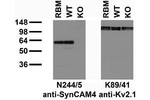 Immunoblot versus adult rat brain membranes (RBM) and adult mouse brain membranes from wild-type (WT) and SynCAM4 knockout (KO) mice and probed with N244/5 (left) and K89/41 (right) TC supe.
