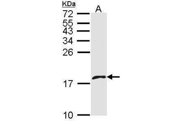 PF4V1 antibody  (C-Term)