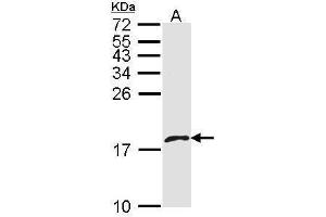 WB Image Sample (30 ug of whole cell lysate) A: A431 , 15% SDS PAGE antibody diluted at 1:1000 (PF4V1 antibody  (C-Term))
