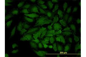 Immunofluorescence of monoclonal antibody to GJB3 on HeLa cell. (Connexin 31 antibody  (AA 1-270))