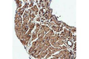 IHC analysis of Actin using anti-Actin antibody (ABIN3043519).
