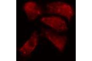 ABIN6274152 staining A549 cells by IF/ICC. (Histone H1 antibody  (Internal Region))