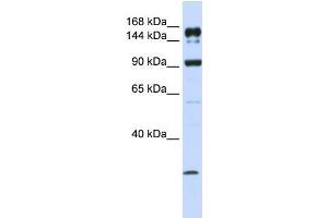 Human MCF-7; WB Suggested Anti-ABCA5 Antibody Titration: 1 ug/ml. (ABCA5 antibody  (C-Term))