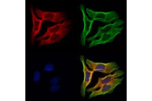 ABIN6262116 and ABIN6273047 staining Hela cells by IF/ICC.