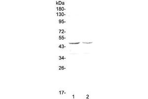 Western blot testing of human 1) HepG2 and 2) MCF7 cell lysate with GALT antibody at 0. (GALT antibody)