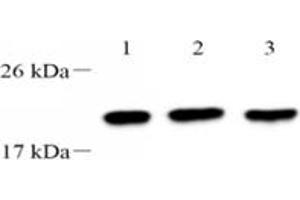 Western blot analysis of TPPP3 (ABIN7076047),at dilution of 1: 2000,Lane 1: 293 cell lysate,Lane 2: PC3 cell lysate,Lane 3: A549 cell lysate (TPPP3 antibody)