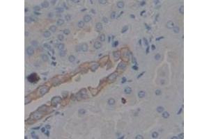 IHC-P analysis of Human Tissue, with DAB staining. (IL18R1 antibody  (AA 375-428))