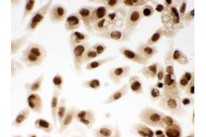 Immunohistochemistry (IHC) image for anti-Damage Specific DNA Binding Protein 1 (DDB1) (AA 1011-1140) antibody (ABIN3043823)