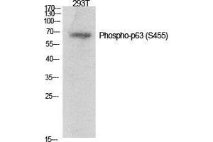Western Blotting (WB) image for anti-T-Complex 1 (TCP1) (pSer455) antibody (ABIN3182583)