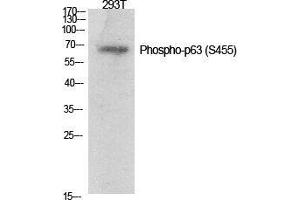 Western Blot (WB) analysis of specific cells using Phospho-p63 (S455) Polyclonal Antibody.