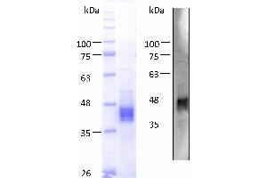 Western Blotting (WB) image for Proline Rich, Lacrimal 1 (PROL1) (AA 22-248) protein (His tag) (ABIN3105840)
