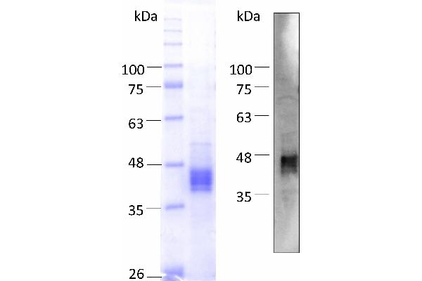 PROL1 Protein (AA 22-248) (His tag)