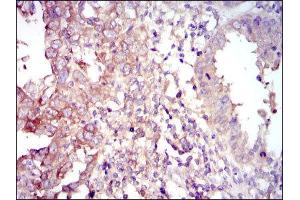 Immunohistochemistry (IHC) image for anti-Forkhead Box O1 (FOXO1) antibody (ABIN1845870) (FOXO1 antibody)