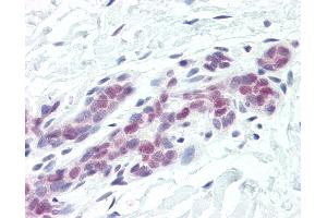 Anti-DFFA / ICAD antibody IHC of human breast. (DFFA antibody  (AA 2-21))