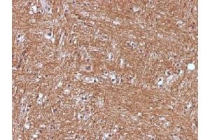 Immunohistochemistry (IHC) image for anti-Enolase 2 (Gamma, Neuronal) (ENO2) (AA 416-433) antibody (ABIN4949836)