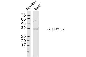 Mouse Liver lysates probed with SLC35D2 Polyclonal Antibody, Unconjugated  at 1:300 dilution and 4˚C overnight incubation. (Solute Carrier Family 35 (UDP-GlcNAc/UDP-Glucose Transporter), Member D2 (SLC35D2) (AA 251-326) antibody)