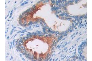 IHC-P analysis of Human Prostate Tissue, with DAB staining. (AGT antibody  (AA 35-485))