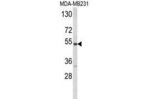 Western Blotting (WB) image for anti-Cytochrome P450, Family 2, Subfamily A, Polypeptide 13 (CYP2A13) antibody (ABIN3003850)