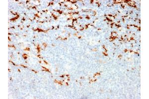 Formalin-fixed, paraffin-embedded human Lymph Node in Colon stained with CD163 Mouse Monoclonal Antibody (M130/2164).