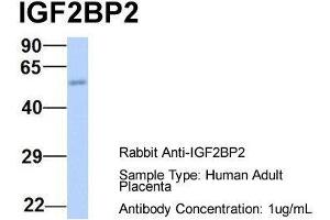 Host:  Rabbit  Target Name:  IGF2BP2  Sample Type:  Human Adult Placenta  Antibody Dilution:  1. (IGF2BP2 antibody  (Middle Region))