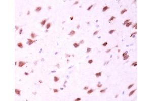 IHC-P Image MFN2 antibody [N1N2], N-term detects MFN2 protein at cytosol on mouse fore brain by immunohistochemical analysis. (MFN2 antibody  (N-Term))