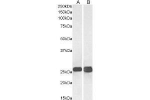 Western Blotting (WB) image for anti-Synaptosomal-Associated Protein, 25kDa (SNAP25) antibody (ABIN5894455) (SNAP25 antibody)