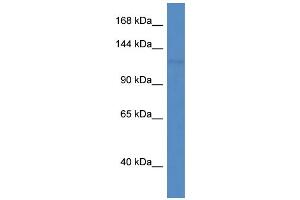 WB Suggested Anti-Pnpla6 Antibody   Titration: 1. (PNPLA6 antibody  (C-Term))