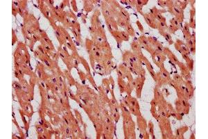 IHC image of ABIN7150351 diluted at 1:600 and staining in paraffin-embedded human heart tissue performed on a Leica BondTM system. (TOP1MT antibody  (AA 270-400))