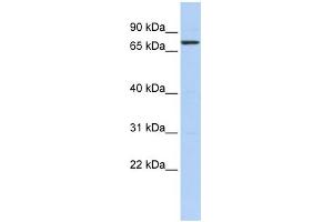 WB Suggested Anti-KLHL5 Antibody Titration:  0. (KLHL5 antibody  (N-Term))