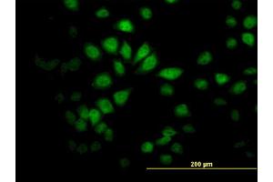 Immunofluorescence of monoclonal antibody to SAV1 on HeLa cell. (SAV1 antibody  (AA 300-383))