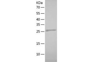 Western Blotting (WB) image for CCR4-NOT Transcription Complex, Subunit 8 (CNOT8) (AA 1-292) protein (His tag) (ABIN7289251) (CNOT8 Protein (AA 1-292) (His tag))